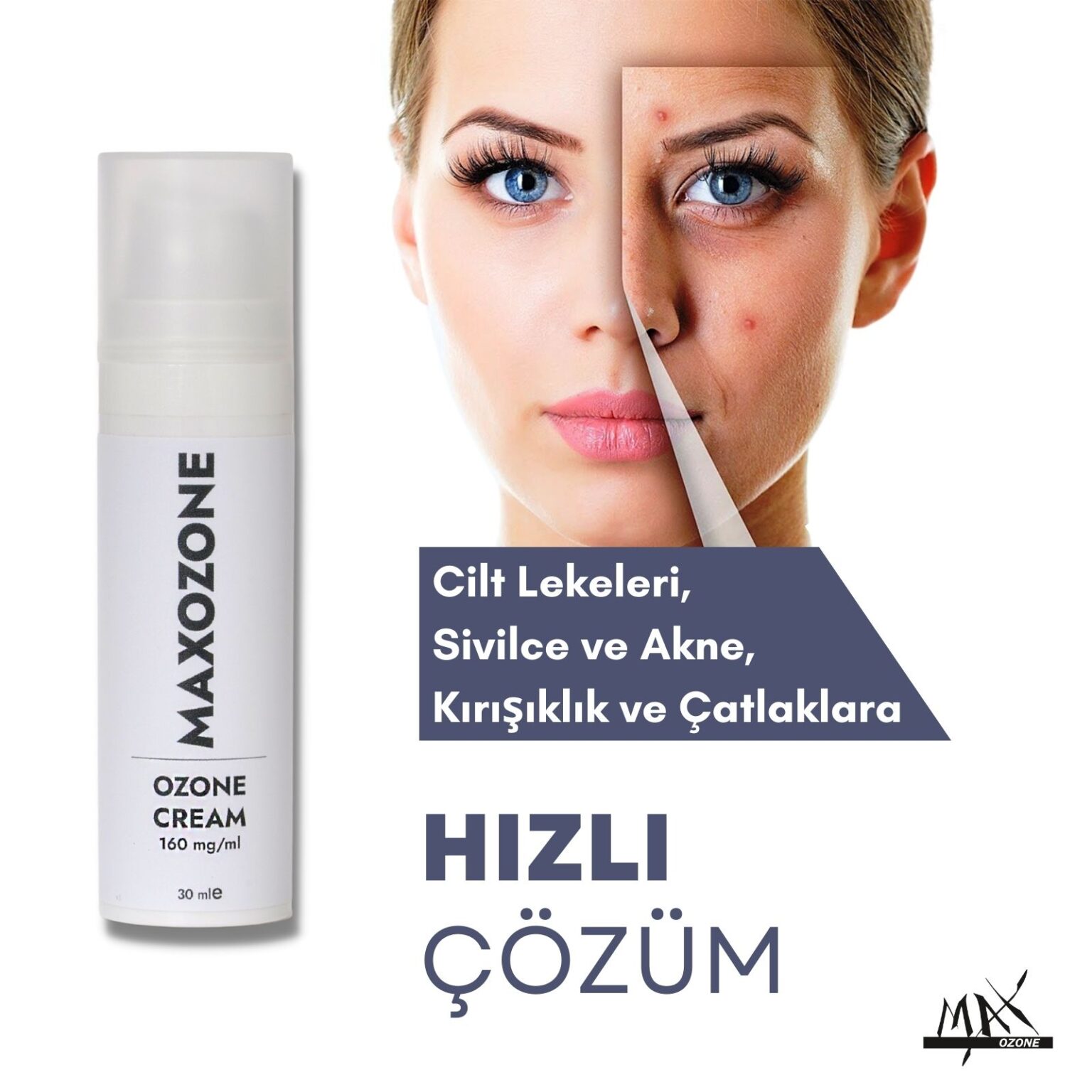 maxozone cilt onarıcı yoğun ozon kremi 160mg/ml