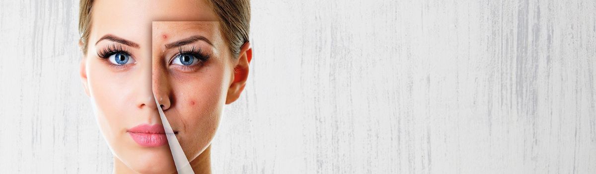 ozon jeli tek ürün yeter slider