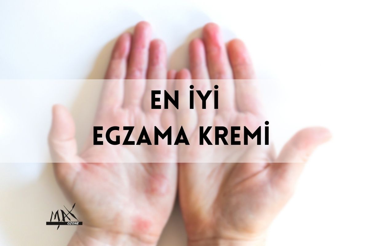 en iyi egzama kremi hangisi? ozonlu egzama kremi kullanıcı yorumları